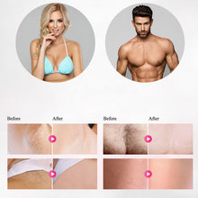 Load image into Gallery viewer, LippyTime IPL Laser Hair Removal
